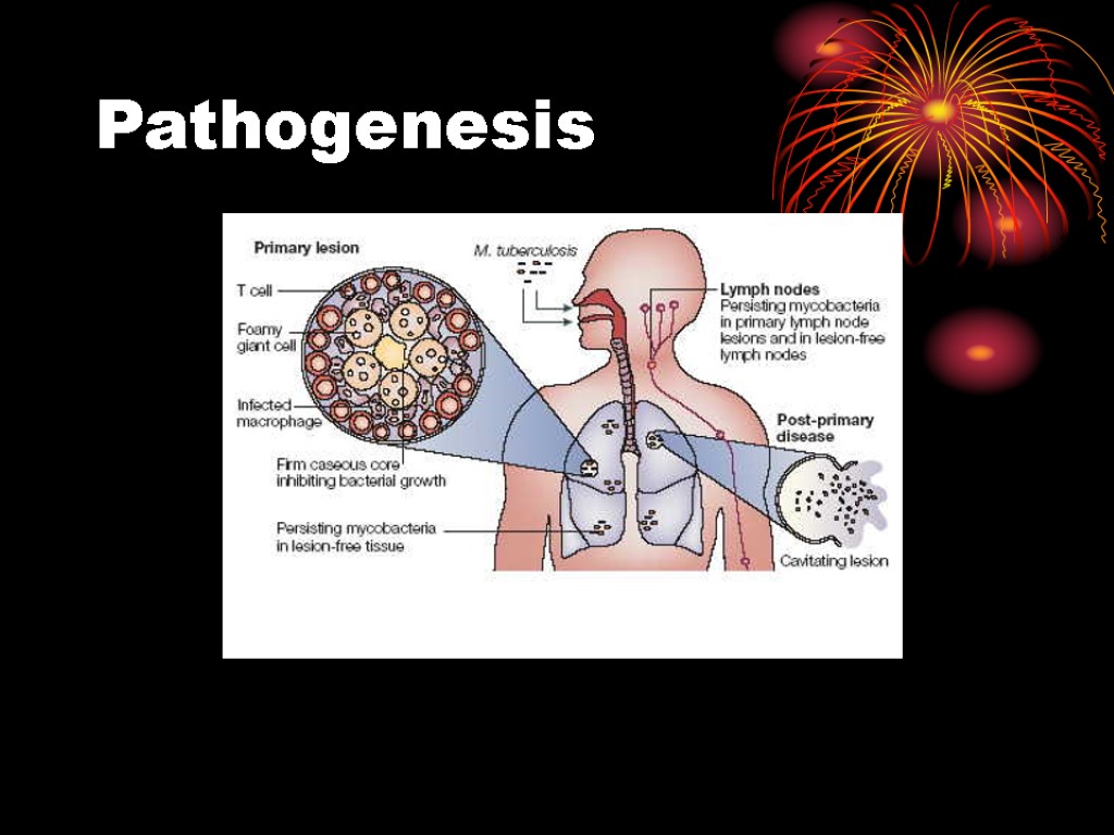 Pathogenesis